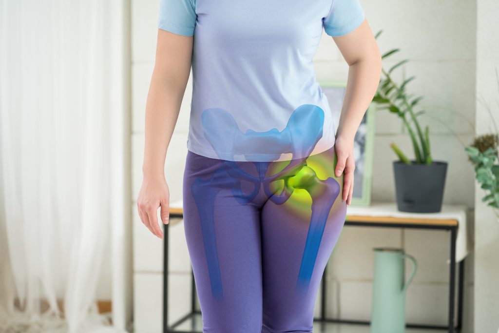 Osteoporoza – mało znana, a wyjątkowo poważna i powszechna choroba naszych kości