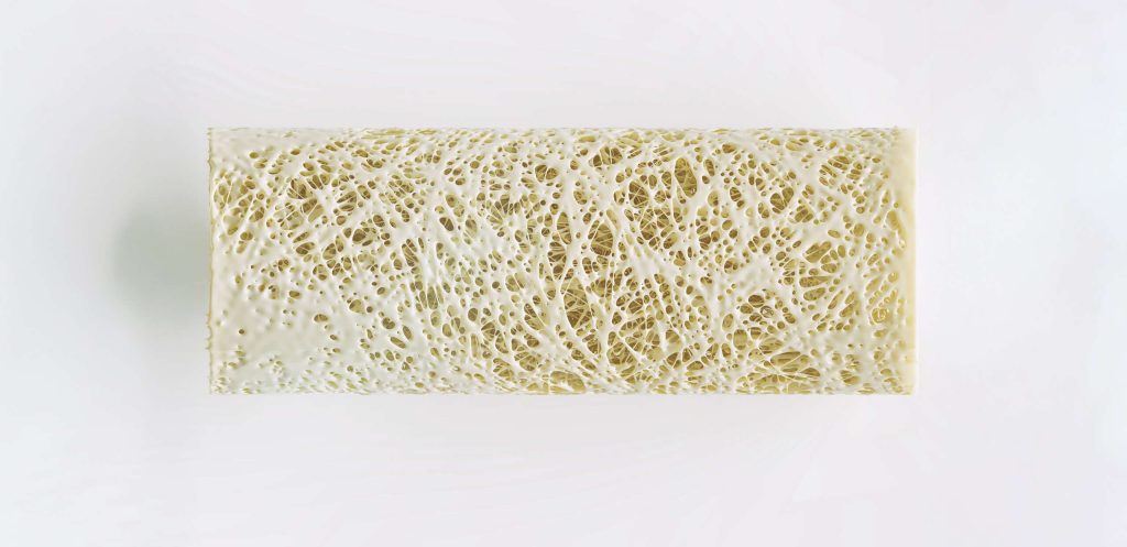 Badania densytometryczne (badanie gęstości kości) w diagnostyce osteoporozy