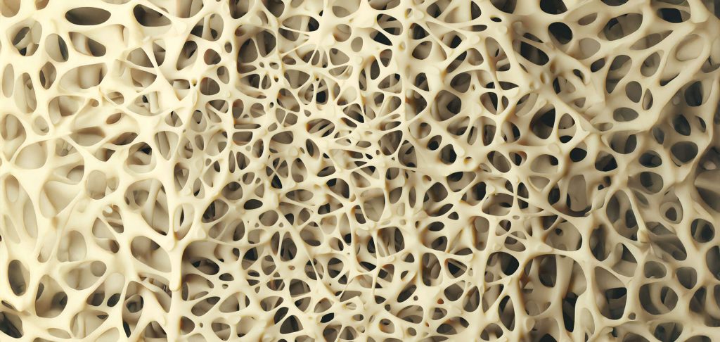 Reumatolog czy ortopeda? Jaki lekarz leczy osteoporozę?