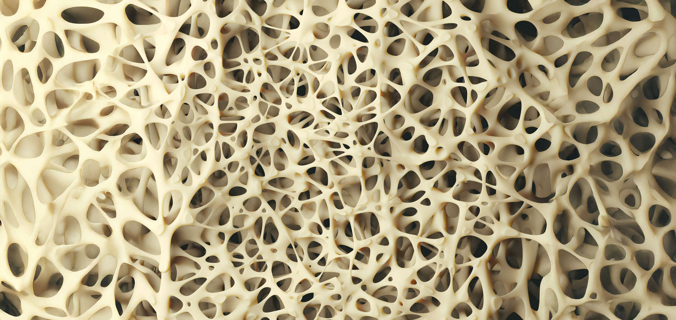 Reumatolog czy ortopeda? Jaki lekarz leczy osteoporozę?